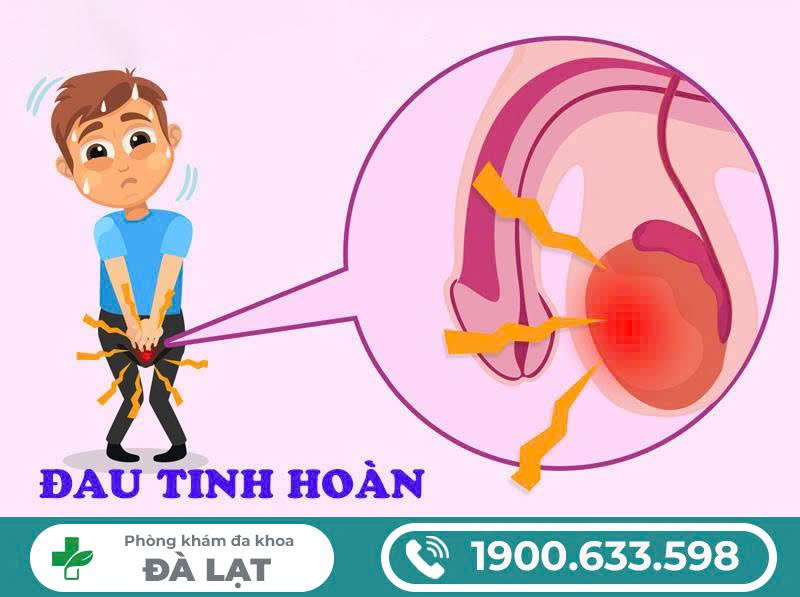 Hình ảnh minh họa